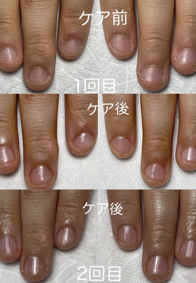 💅最強ネイルケア💅