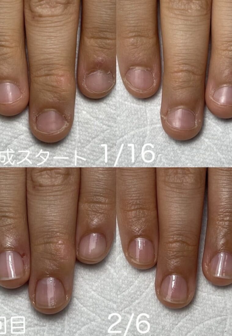 💅最強ネイルケアメソッドお客様💅